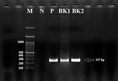 First molecular evidence of Clostridium perfringens in adult Fasciola spp. isolates in cattle hosts